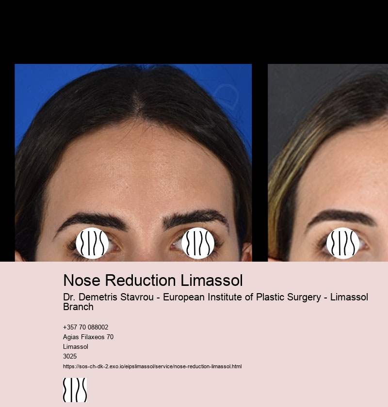 Nose Reduction Limassol