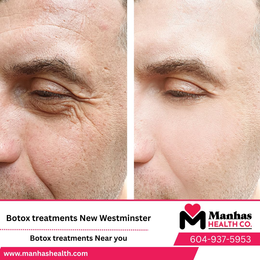 Botox and Filler Clinic for lips