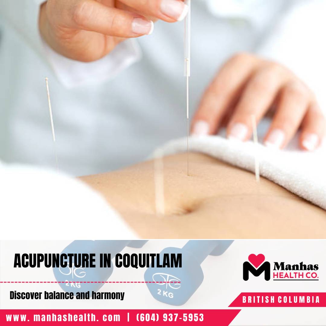 Custom Physio Programs Physiotherapy Assessment Coquitlam