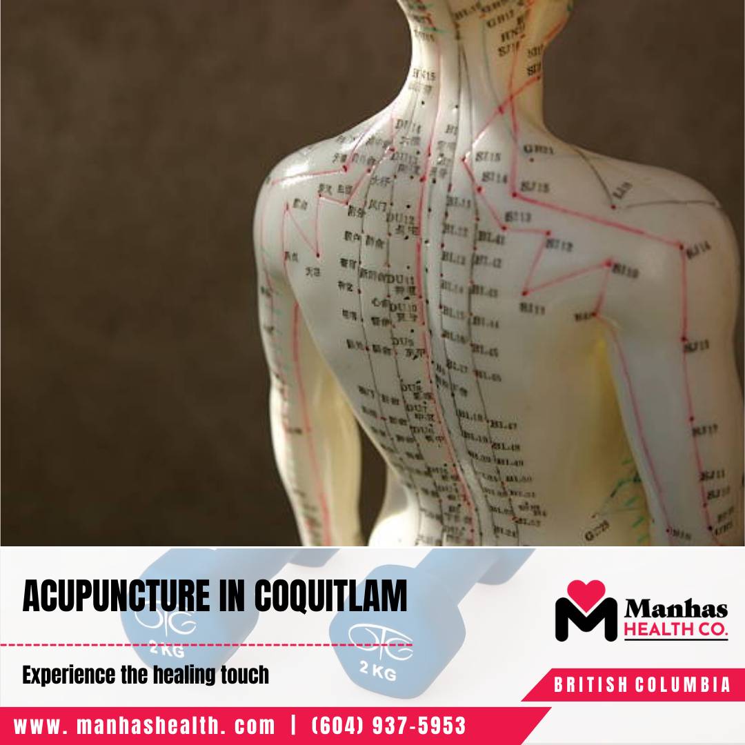 Acupuncture Physiotherapy Physiotherapy Services Coquitlam