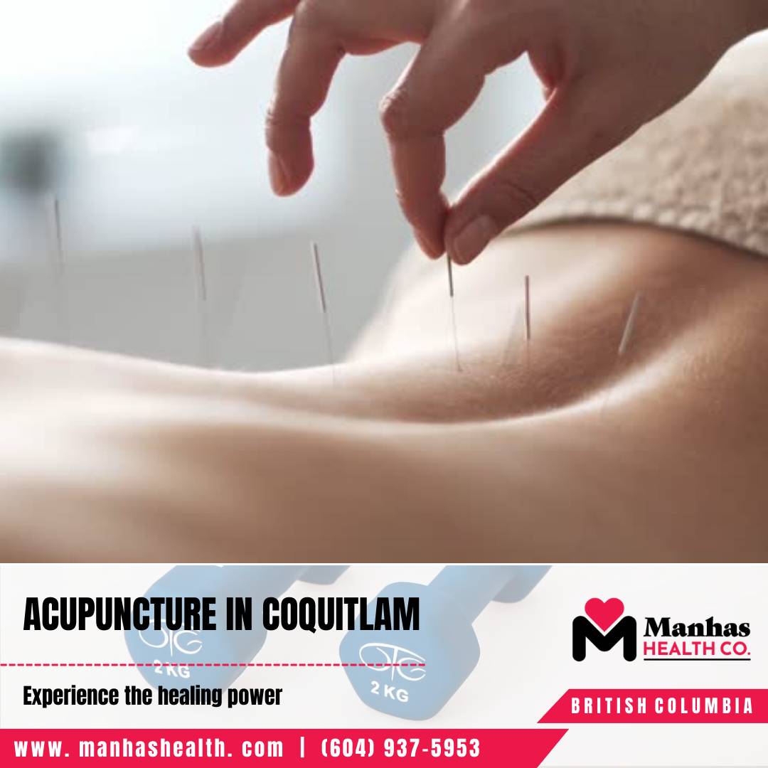 Physiotherapy for Pain Relief Physiotherapists in Coquitlam