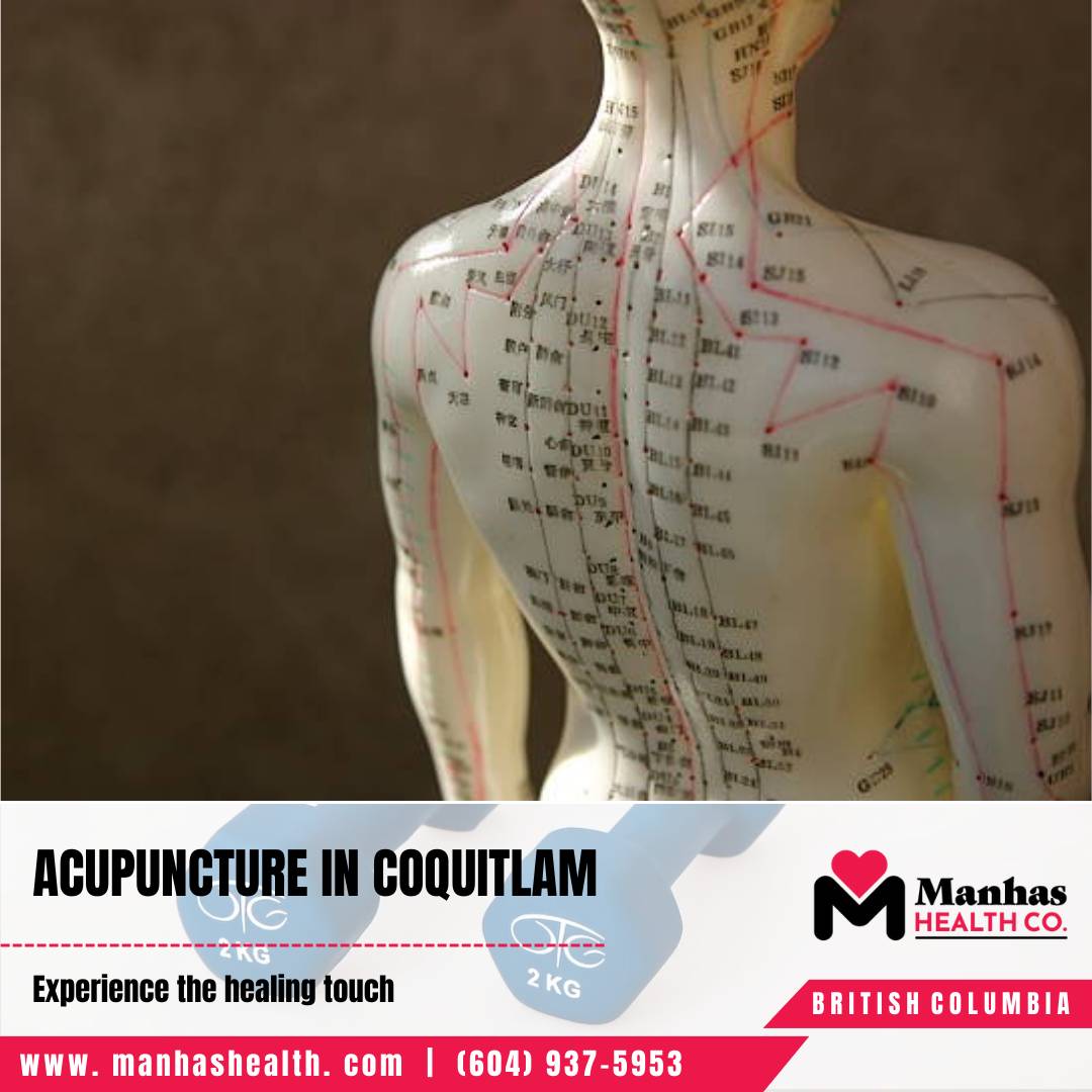 Experienced Physiotherapists for Sports Recovery Physiotherapy Center Coquitlam