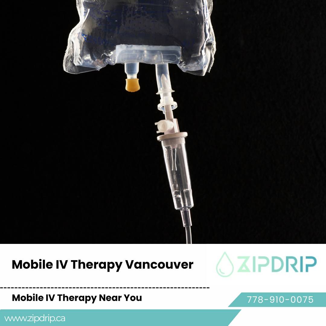 Anti-Stress IV Drip Vancouver Mobile IV Hydration