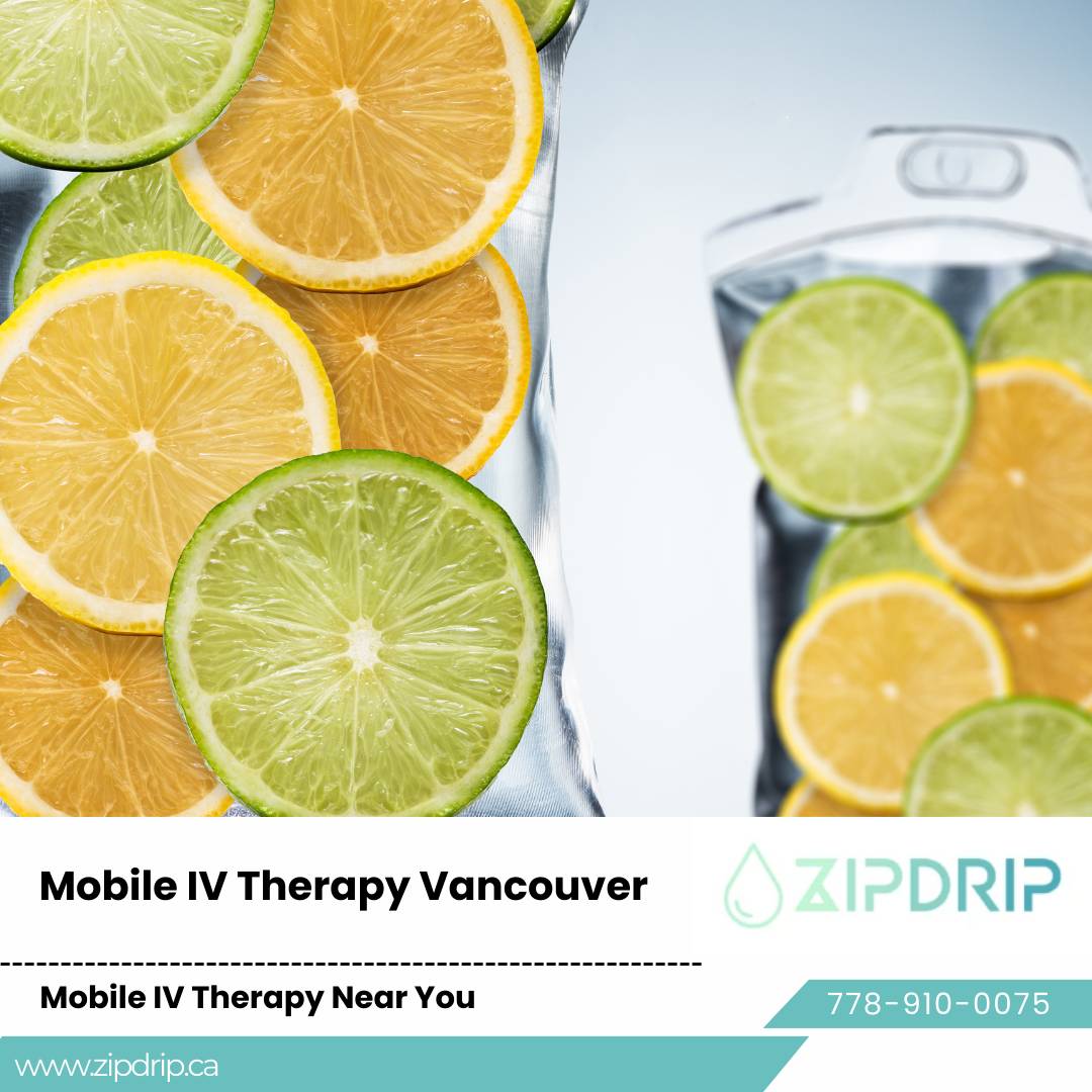 IV Drip For Wellness IV Vitamin Infusion Vancouver