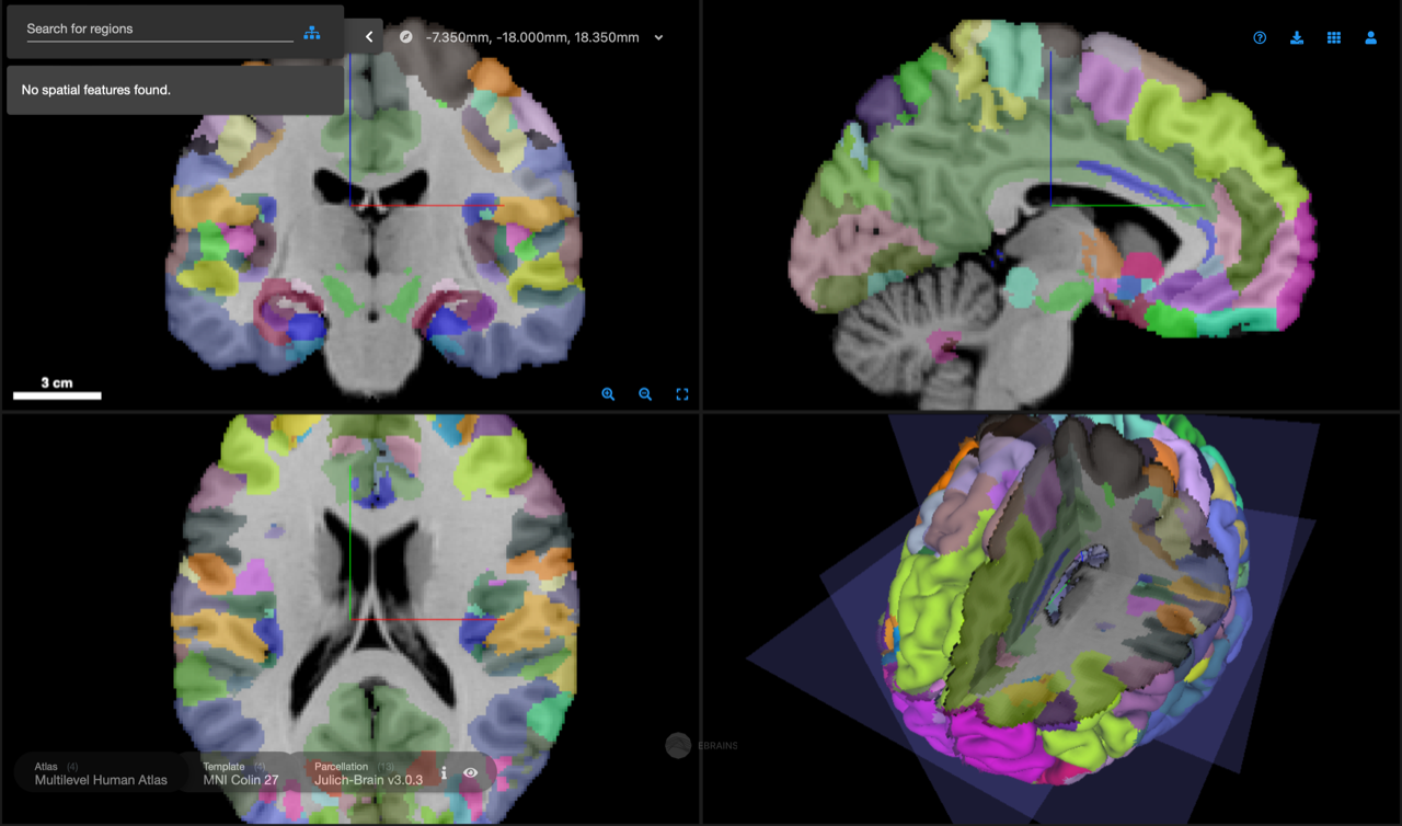 What is Brain Science? - Regional Neurological Associates