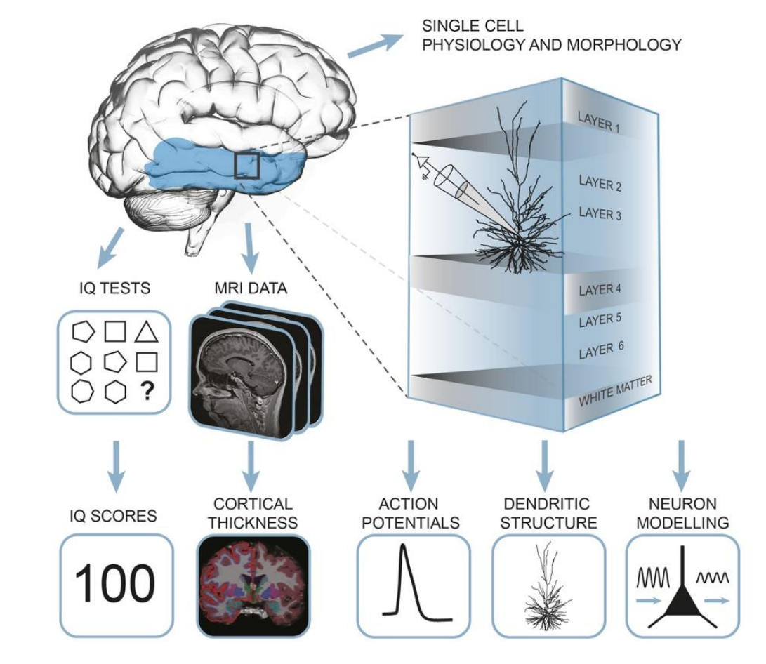 intelligent brain mri