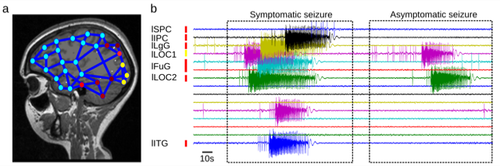 http://hrvatski-fokus.hr/wp-content/uploads/2019/03/ez.png__500x0_q85_subsampling-2_upscale.png