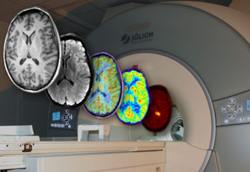 Neuroimaging And The Future Of Brain Cartography