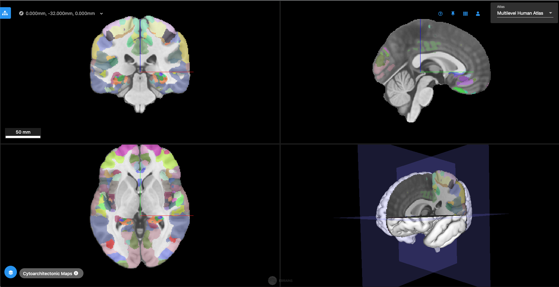 New release of the EBRAINS Interactive Atlas Viewer.png