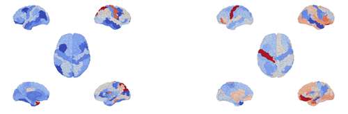 Brain Models 4.png