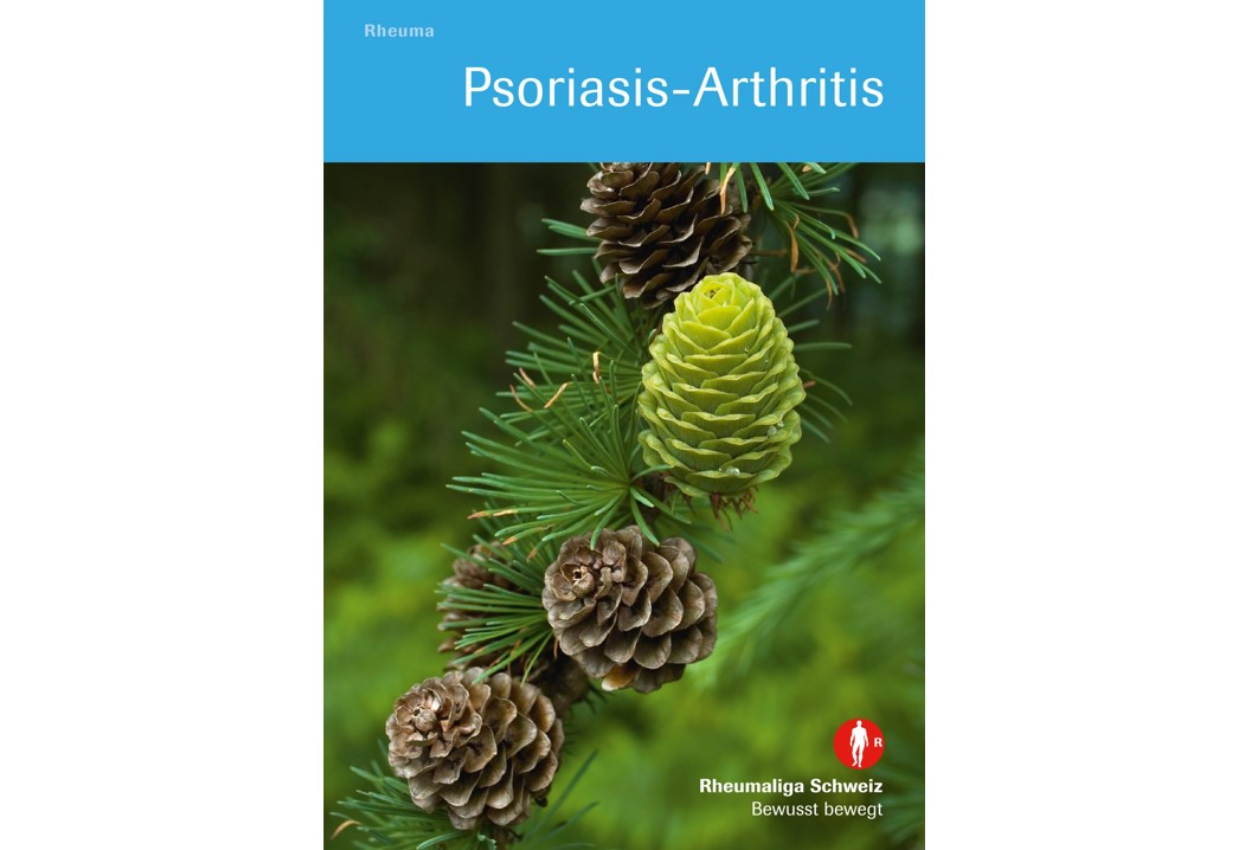 Psoriasis Arthritis