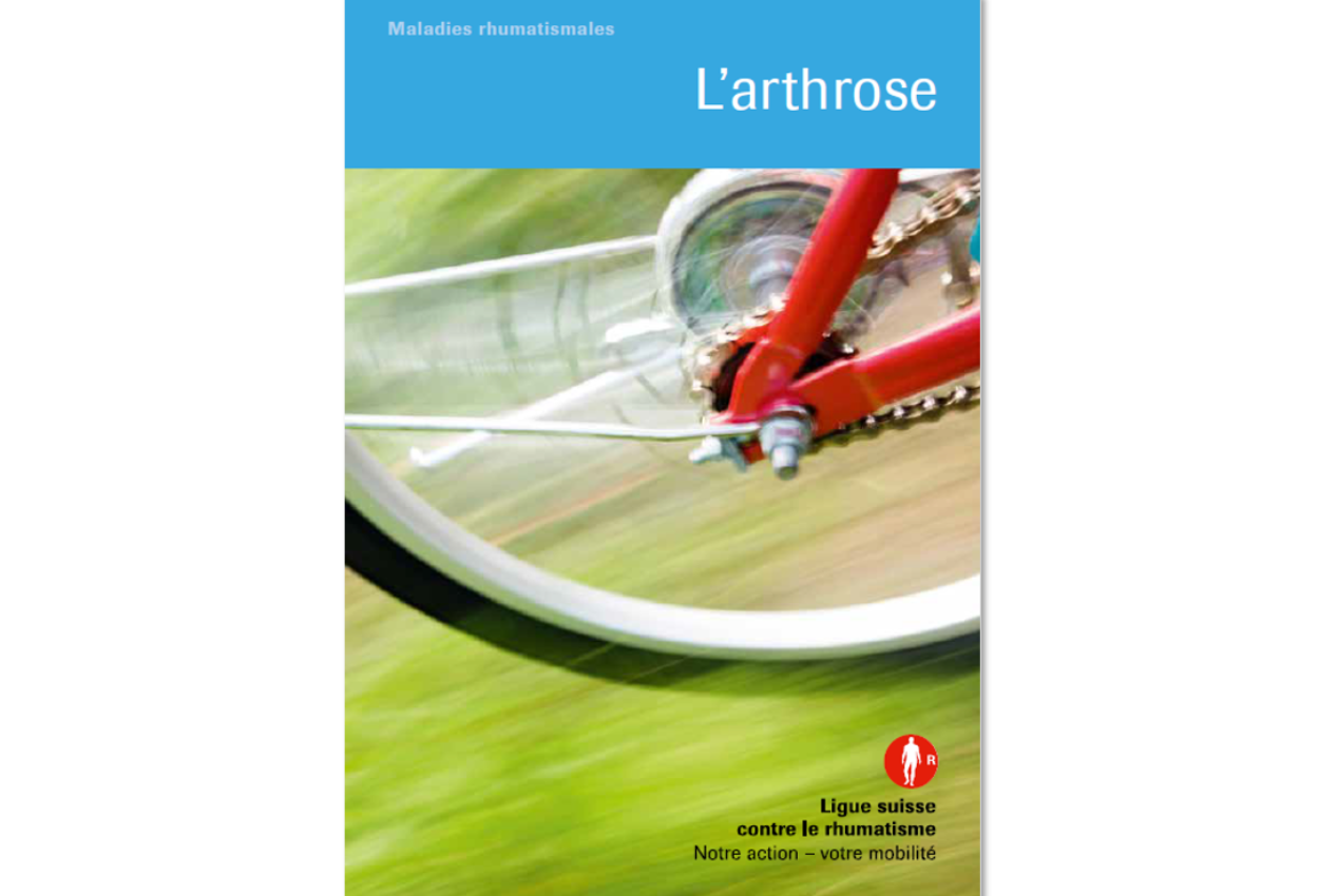 L'arthrose