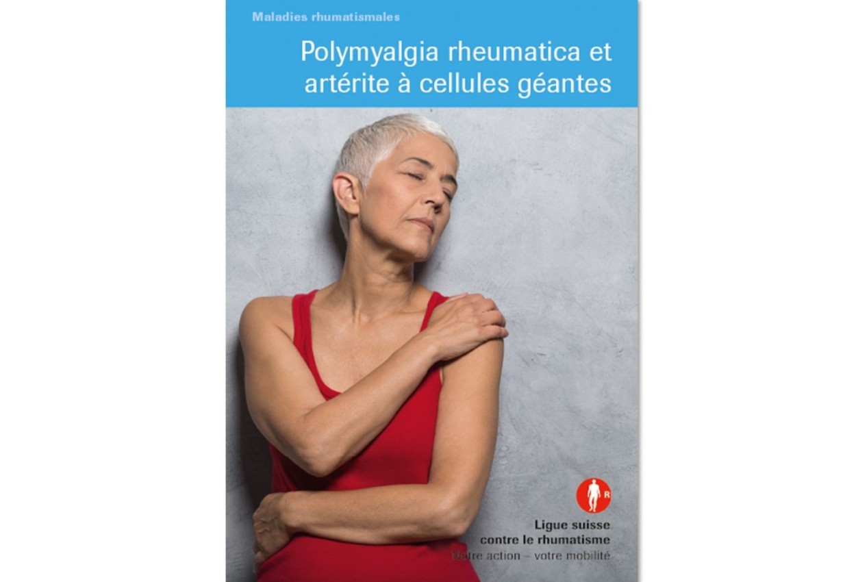 Polymyalgia rheumatica et artérite à cellules géantes