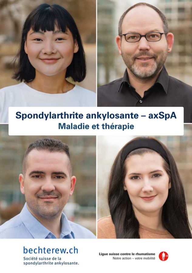 Société CH de la spondylarthrite ankylosante