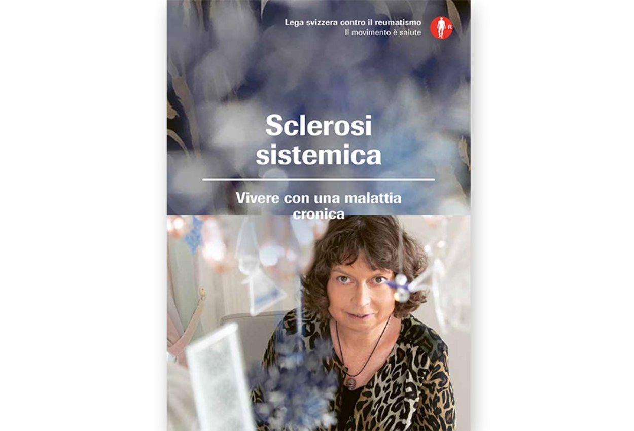 Sclerosi sistemica