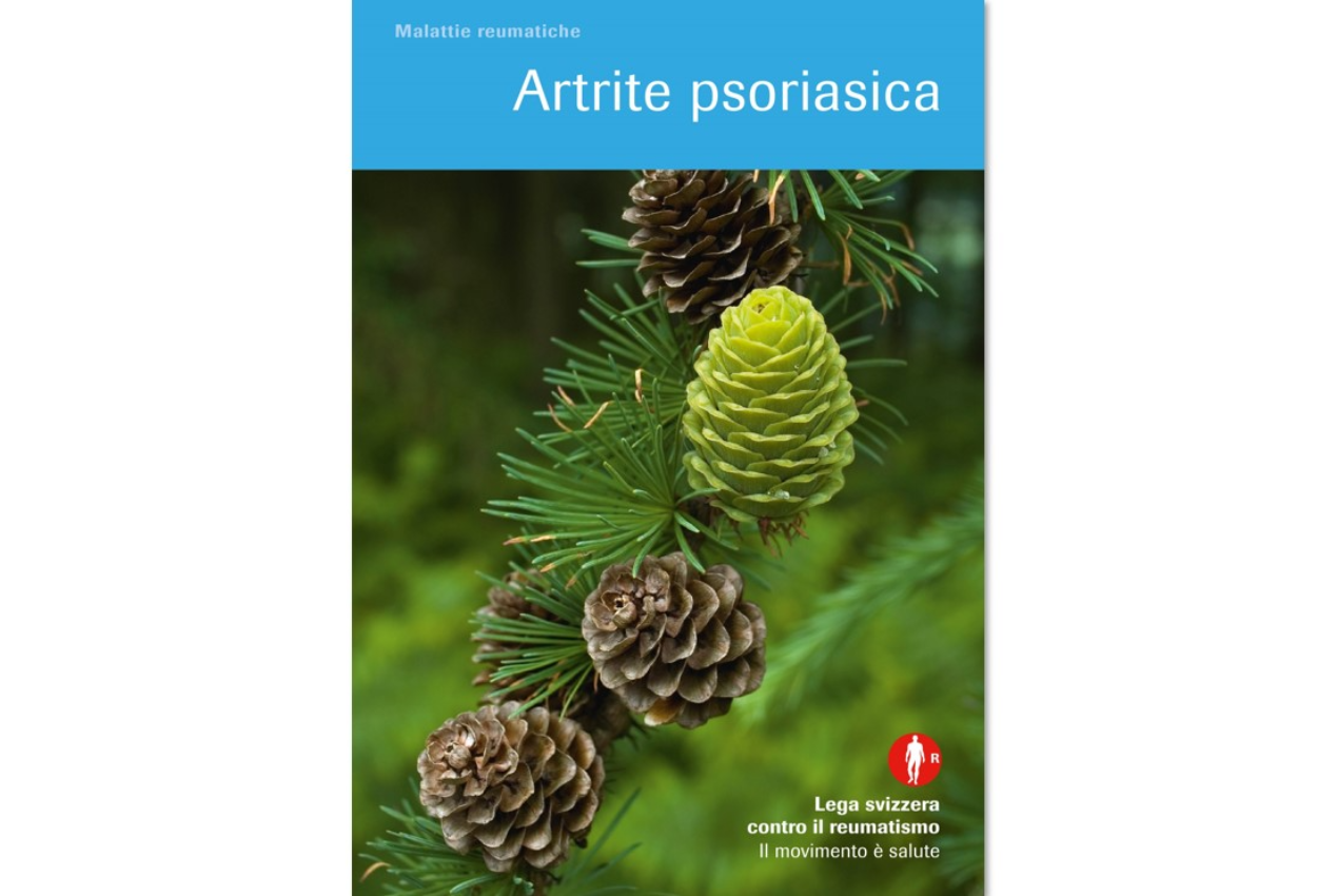 Artrite psoriasica